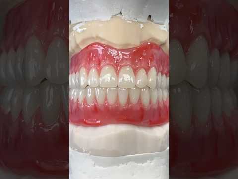 Amazing Try-In #lsk121shorts #dentist #teeth