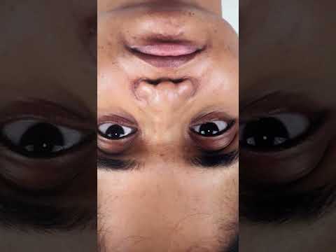 Nasal Reconstructive rhinoplasty