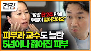 "막을 수 없는 노화! 하지만 젊어질 수 있다면?" 피부과 교수가 말하는 피부 젊어지는 방법 3가지｜귀하신 몸｜#EBS건강