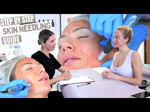 7 Step Skin Needling Treatment | Step By Step Procedure Performance Tutorial | Level 4 VTCT Course