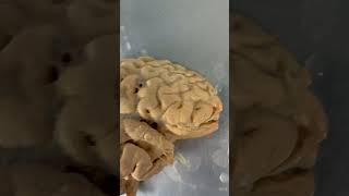 REAL Human Brain & Processing Vision!