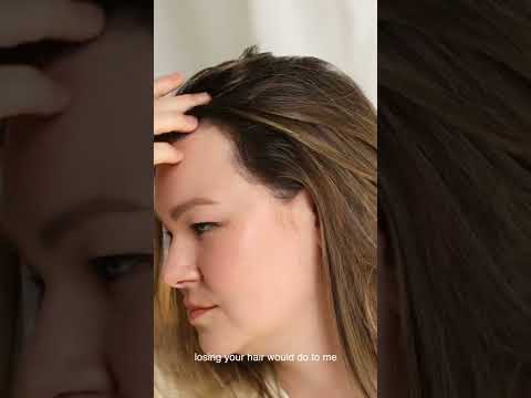 Thinning Hair Solution | Post-Partum Hair Loss