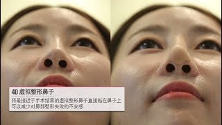 韩国Olive整形外科_4D隆鼻手术