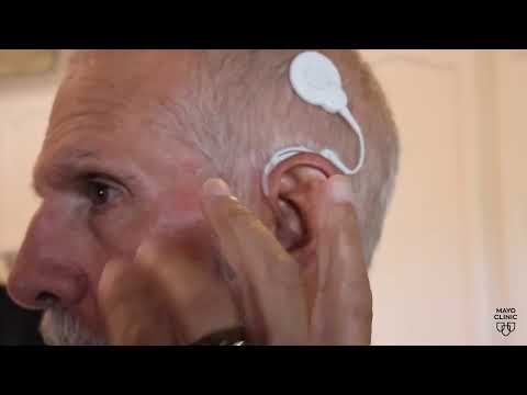 Hope, healing, hearing: How a cochlear implant helps a man hear again