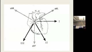 2023-01-19 Session 1B: ECG Cases: A Primer