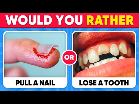 Would You Rather...? 100 HARDEST Choices Ever!🔥😱🧠 EXTREME Edition