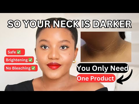 HOW TO TREAT AND GET RID OF DARK NECK & HYPERPIGMENTATION PERMANENTLY FOR A BRIGHT AN EVEN SKIN-TONE