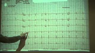 ECG Cases 1