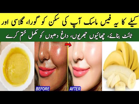 Skin Whitening Banana Face Pack | Get Fair Spotless, Glowing Skin 100% Work | Glowing Skin Remedy