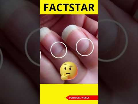 Do You Have This White part on your nails? | #factstarshorts #youtubeshorts #shorts #ytshorts