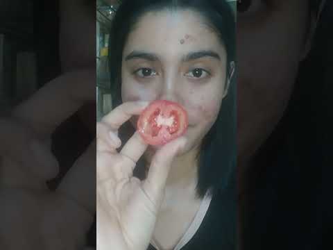 remove ance masks try diy #ashortaday #shorts #youtubeshorts #shortsvideo #skincare