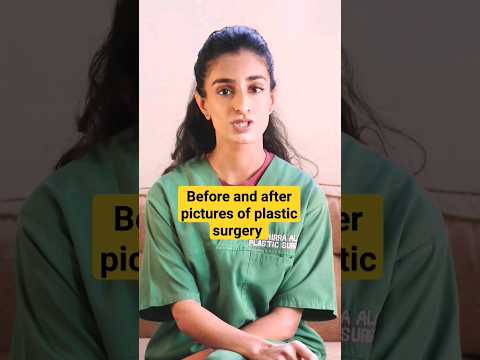 Makeup hides plastic surgery results! #makeup #short