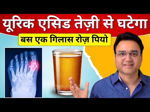 रोज़ एक गिलास ये पियो, Uric Acid कभी नहीं बढ़ेगा | Home Remedy For Uric Acid