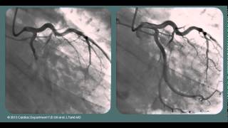 ECG cases IV