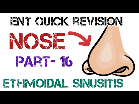 Ethmoidal Sinusitis - Causes, Treatment, Compilation | Dr. Deen's Expert Lecture