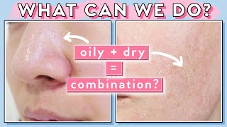 When Your Pores are Oily & Skin is Dry at the Same Time?! Combination Skin Tips!