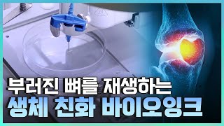 [기술자들] 차세대 의료 분야를 이끌어 갈 기술 / YTN 사이언스