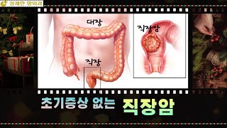 초기 증상 없는 직장암