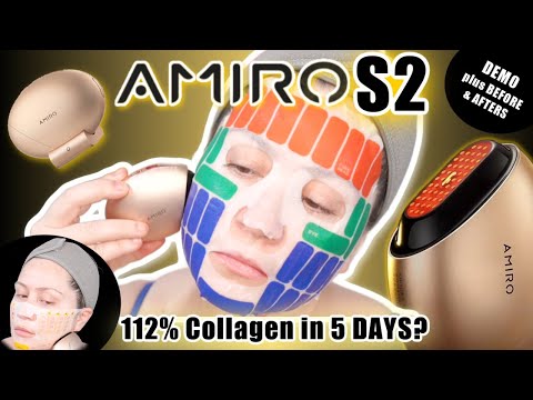 AMIRO S2 Facial RF Skin Tightening Device | DEMO W/ BEFORE & AFTER RESULTS