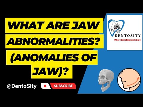 Abnormalities of jaw