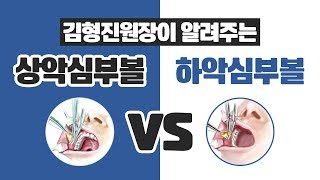 [압구정성형외과 성형상담] 상악심부볼 vs 하악심부볼