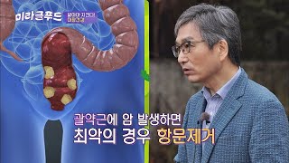 [직장암] 괄약근에 암 발생한 최악의 경우→ 항문 제거(!!)맛있는 이야기 미라클 푸드(jtbcmiraclefood) 1회