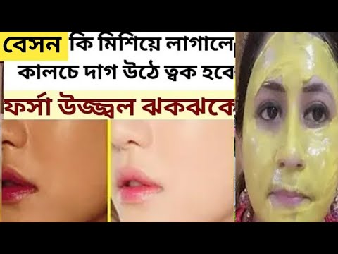 গরমে বেসন এমন কি মিশিয়ে মাখলে ত্বকের কালচে ভাব তুলে একদিনে ত্বক ফর্সা ঝকঝকে হবেঘাম হবে না/Besan Face