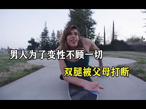 男人通过手术成为女人，却遭到父母的反对，双腿被打断只剩10厘米