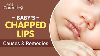 Chapped Lips in Babies - Causes and Treatment