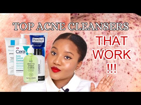 5 BEST ACNE CLEANSERS FOR BREAKOUT PRONE SKIN (SUPER AFFORDABLE)