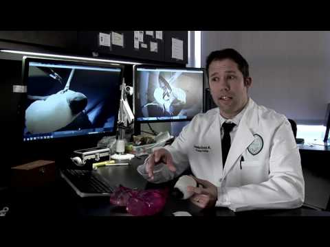 3D Systems - 3D Printing Transforming Medical Care