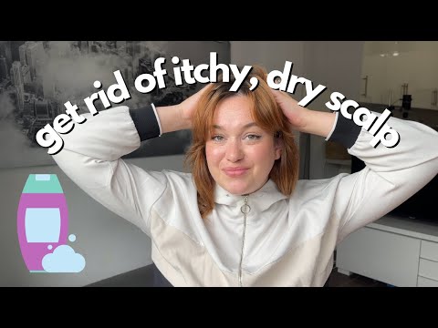 How to Deal With Dry Itchy Scalp | Biochemist Perspective