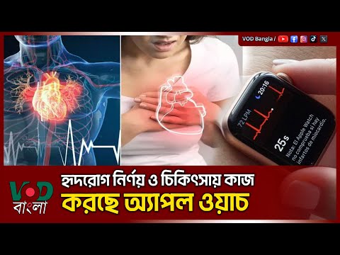 হৃদরোগ নির্ণয় ও চিকিৎসায় কাজ করছে অ্যাপল ওয়াচ | VOD NEWS