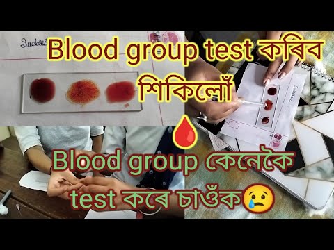 Blood group test কৰিব শিকিলোঁ🤗