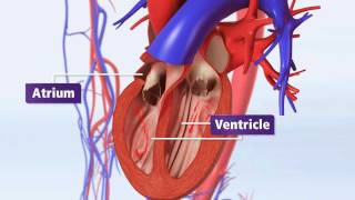 Atrial Fibrillation Animation Explained: AFib & Risk of Stroke