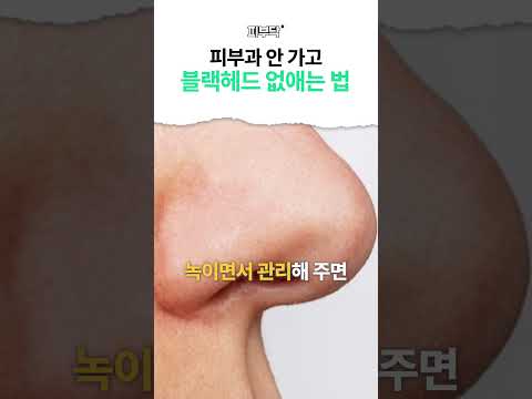 블랙헤드 없애는 가장 좋은 방법! #블랙헤드제거 #블랙헤드 #홈케어