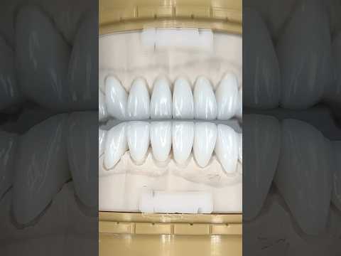 Lower Kosmic Press Hollywood Crowns #lsk121shorts #dentist #teeth