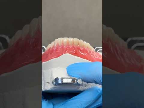 Lower Wax Try-In #lsk121shorts #dentist #teeth