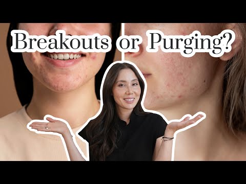 Is Your Skin Purging or Having Breakouts?