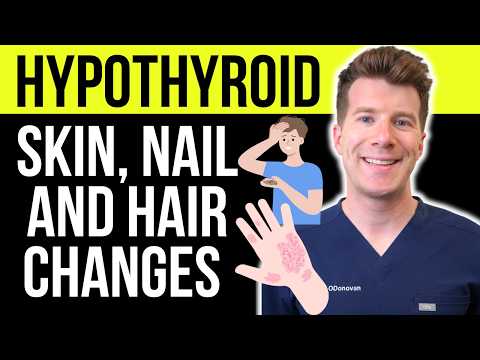 SKIN, NAIL AND HAIR SYMPTOMS associated with UNDER-ACTIVE THYROID (HYPOTHYROIDISM)