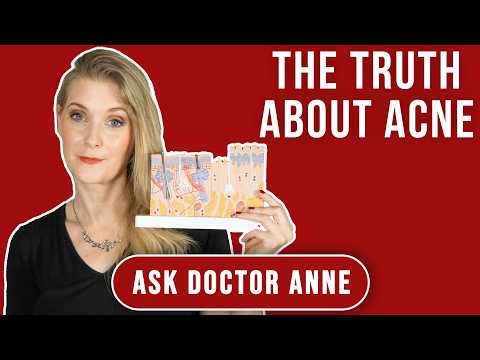 Why You Have Pimples On Your Face (Acne Basics: Causes and Treatment Explained) | Doctor Anne