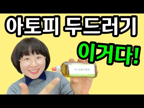 낫기 힘든 아토피 두드러기 가려움 등 피부질환이 있다면, 이걸 피부에 발라보세요! 의사들도 놀랄 일이 벌어집니다!  #알레르기 #피부염 #가려움 #습진