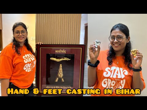 Hand and feet casting in bihar