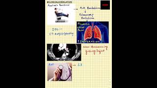 #Shorts|ClinicalCorrelation| NEET/NEXTPG/FMGE/MBBS| Fowler's Position| RHF|S3 | Pleuritic Chest Pain