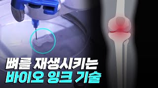 [핫클립] 뼈를 재생시킬 수 있는 바이오 잉크 / YTN 사이언스