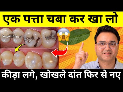 खाने के बाद सिर्फ़ 1 बार चबा लो - न कीड़ा लगेगा न दाँत कभी खोखला होगा | Teeth Cavity