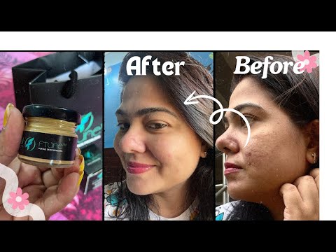 FTune face cream | over night leave-on mask | Remove dark spots | Glowing bright Skin