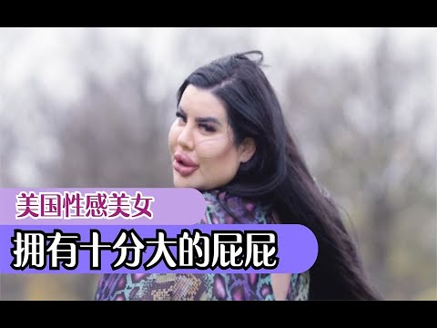 美女拥有大屁屁，为了美丽不断填充，只因奇怪的审美癖