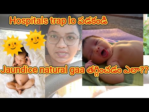 పసి పిల్లలలో  Jaundice common....#jaundice #hospital trap #babies #newborn