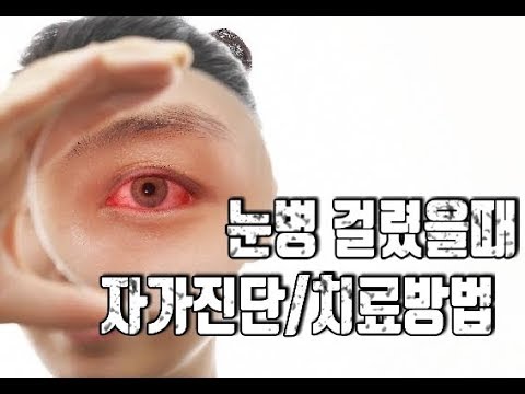 눈병 걸렸을때 눈병 증상 빨리낫는법